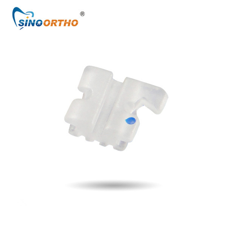 Ceramic Brackets in Orthodontics