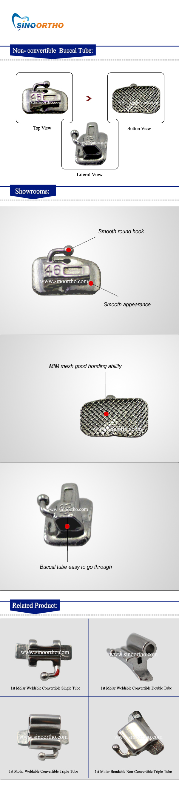Non--convertible--Buccal-Tube