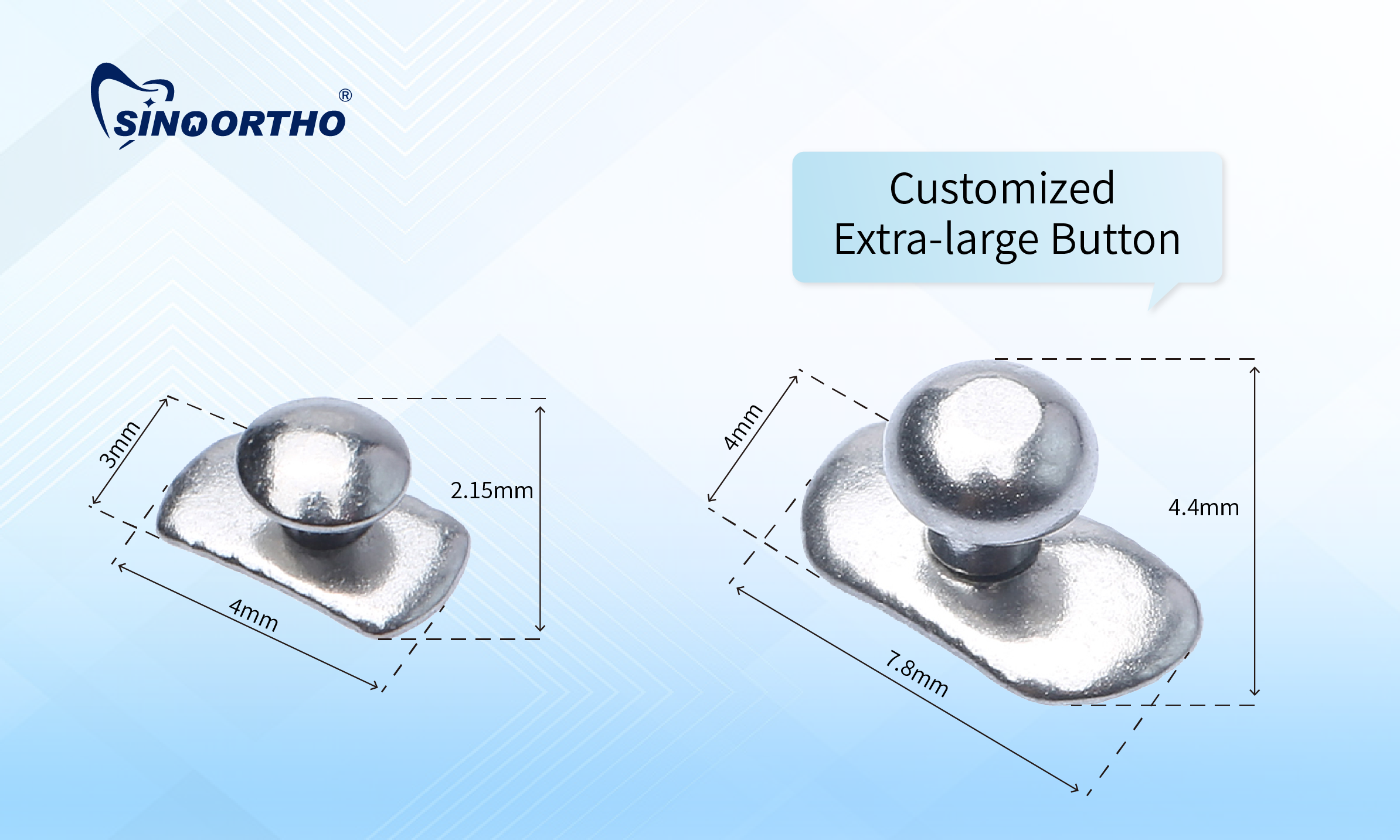 Extra-Large Lingual Buttons Designed for Specific Clinical Preferences