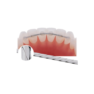 Braided Retainer Wire