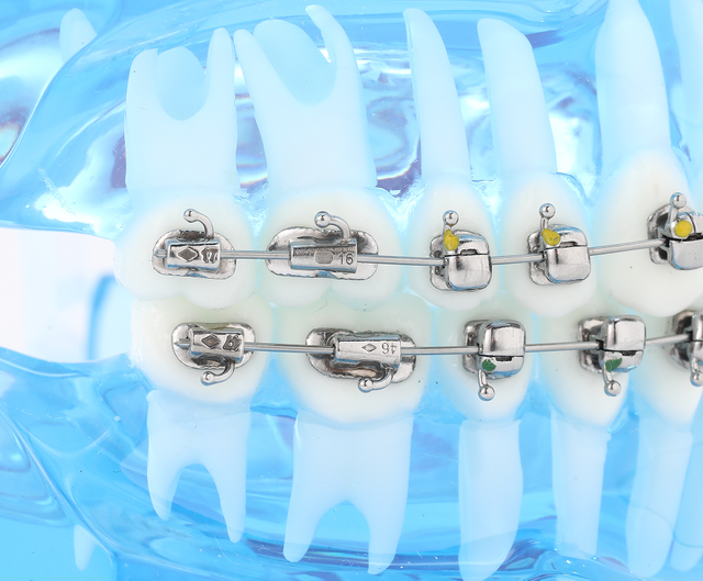 Buccal Tubes (2)